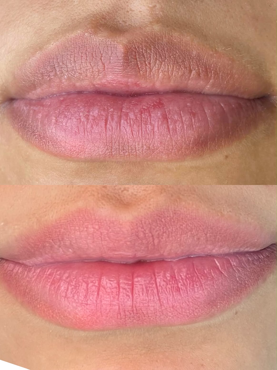 Antes e depois de micropigmentação labial